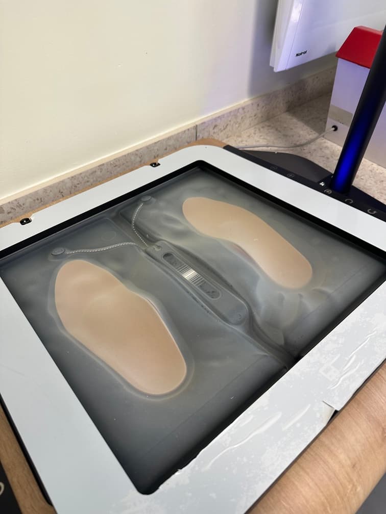 Elaboration de semelles orthopédiques